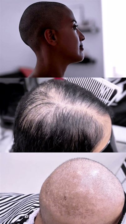ภาพจากคลิปวิกผมสำหรับผู้ป่วยมะเร็ง โดยร้านวิกผม Wewigs Pro
